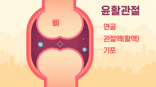 손가락 관절 단면 의학 일러스트, 활액과 기포 형성 과정 묘사