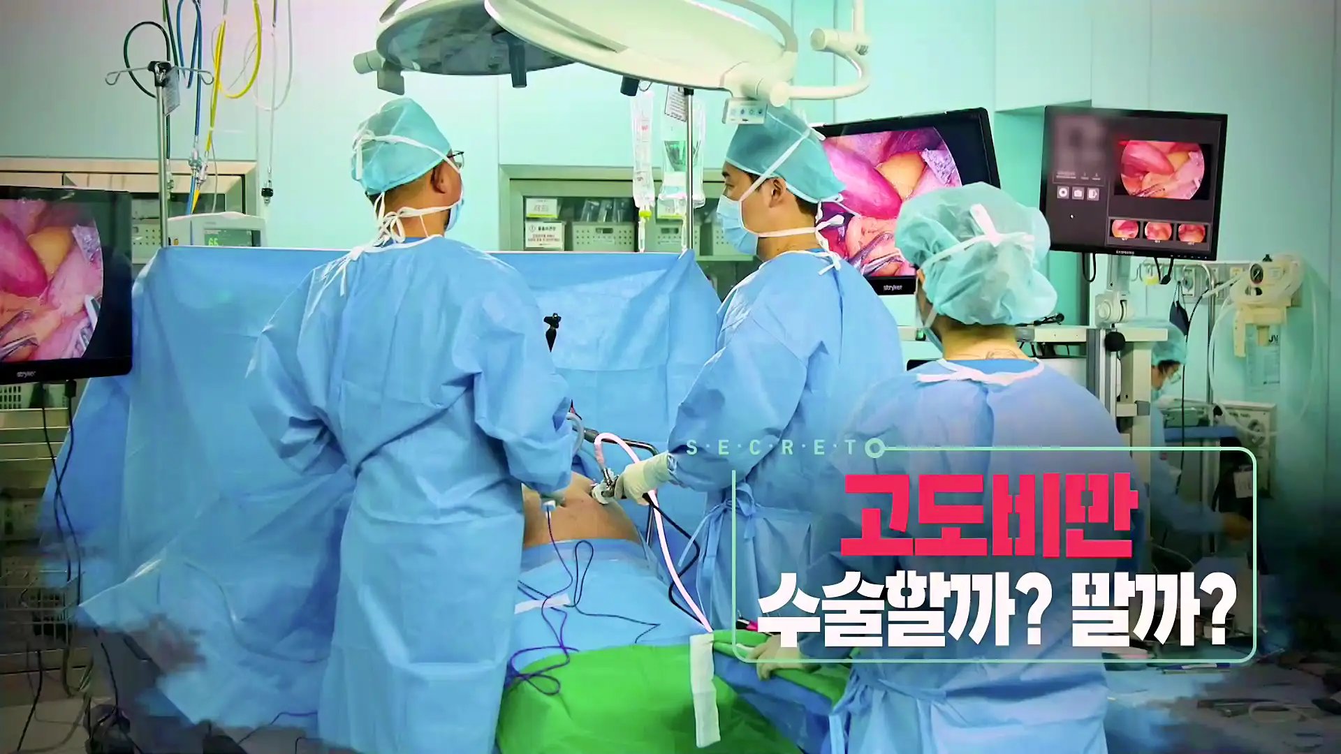 KBS 생로병사의 비밀 827회 최후의 다이어트 고도비만 위절제 수술, 위우회술 수술 차이점과 의료보험 대상 조건