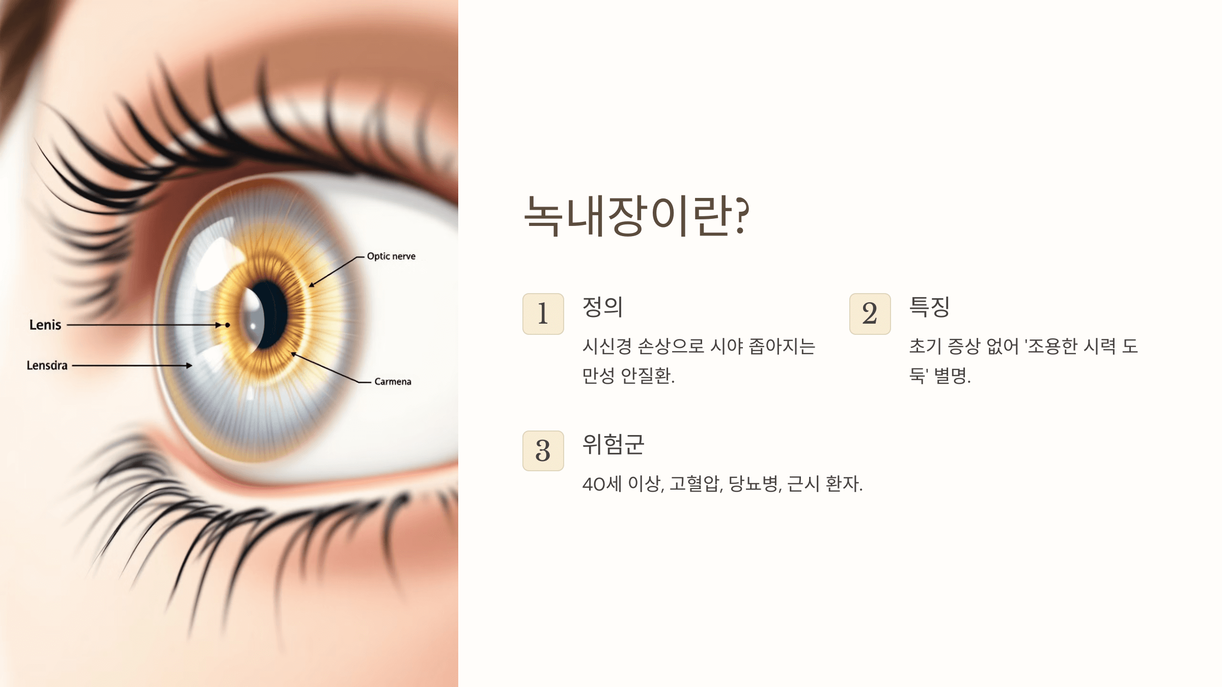 녹내장과 관련된 사진입니다.