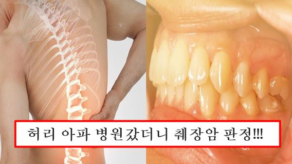췌장암 요통