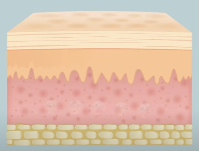 피부장벽-이미지