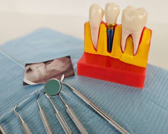 크라운치료-사진3