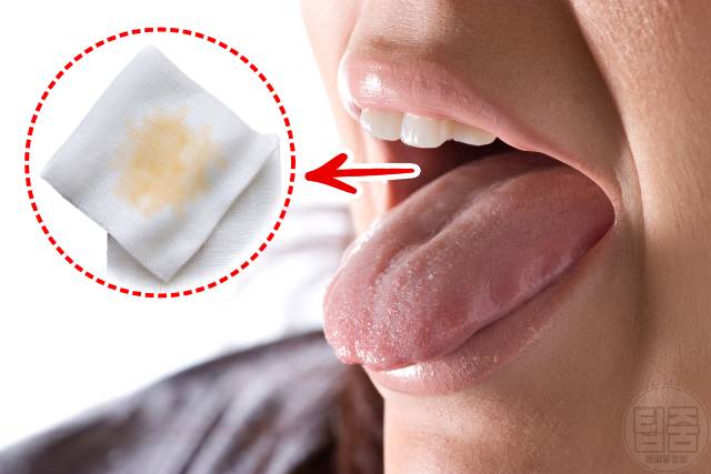 자기 입냄새 확인법,입냄새 자가진단