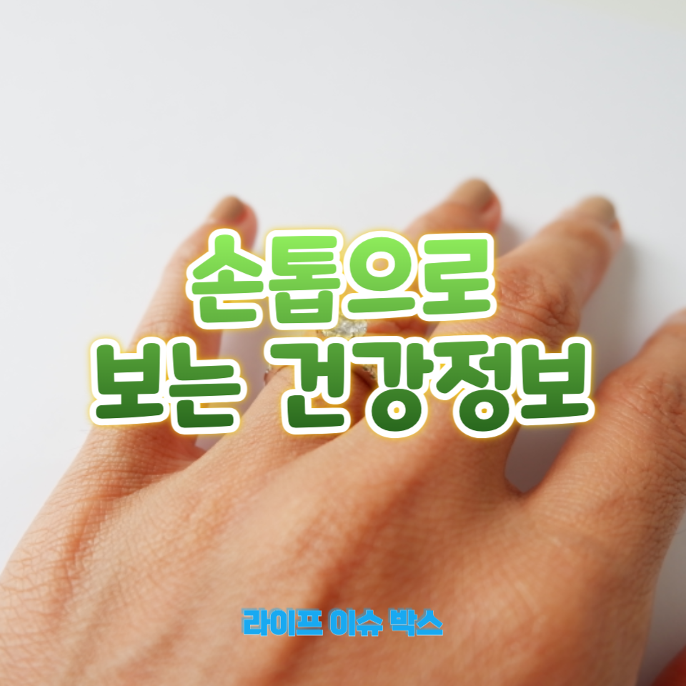 손톱으로 보는 건강정보