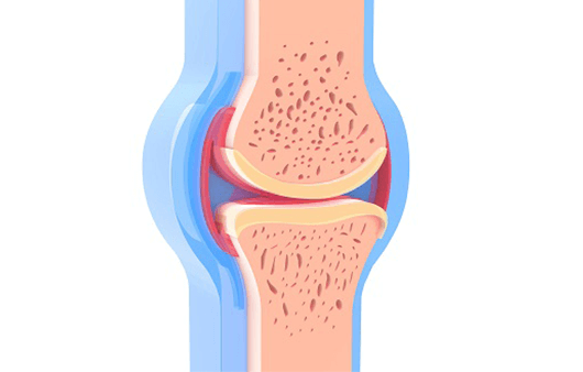 비타민D-부족증상