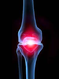 무릎보호대 효과 부작용 (내돈내산 추천)