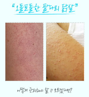 씨퓨리 바디미스트