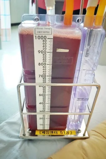 폐에 물이 차는 원인 증상 물참 관리 포인트에 대한 건강정보_17