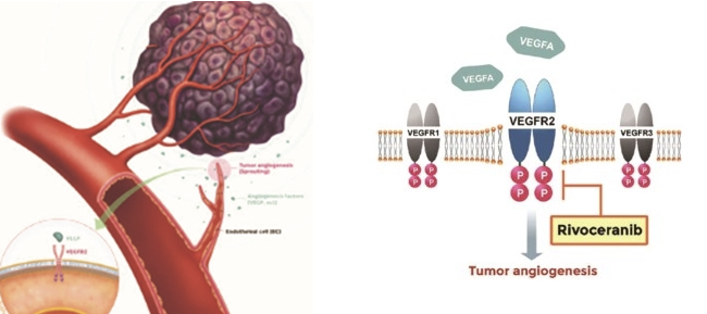 간암 신약 리보세라닙 승인