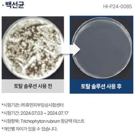 김수로-무좀약-라센털