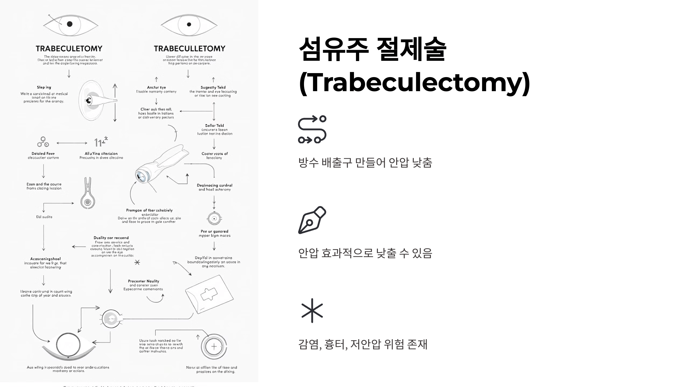 녹내장과 관련된 사진입니다.
