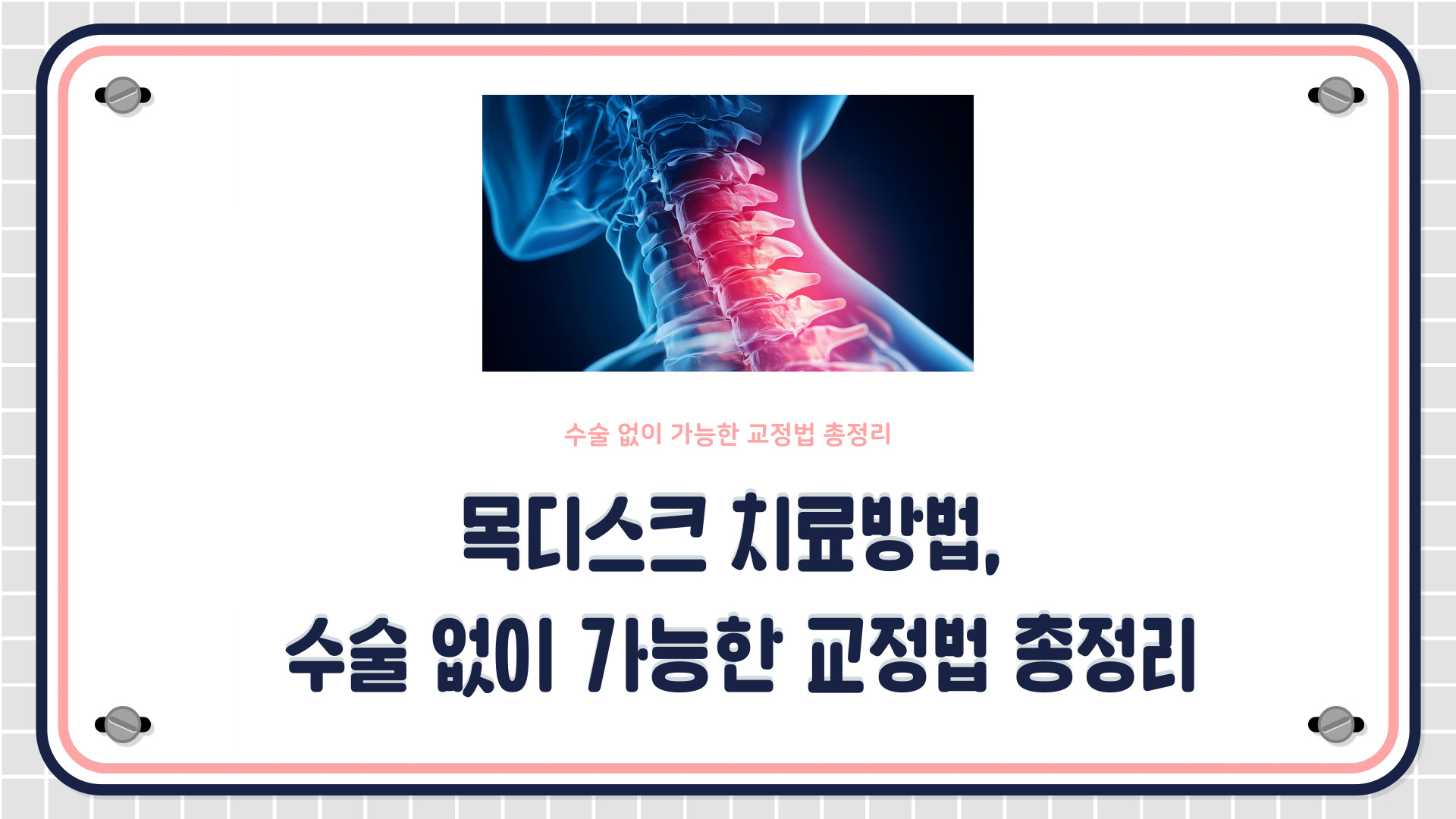 목디스크 치료방법