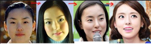 이다희 성형논란