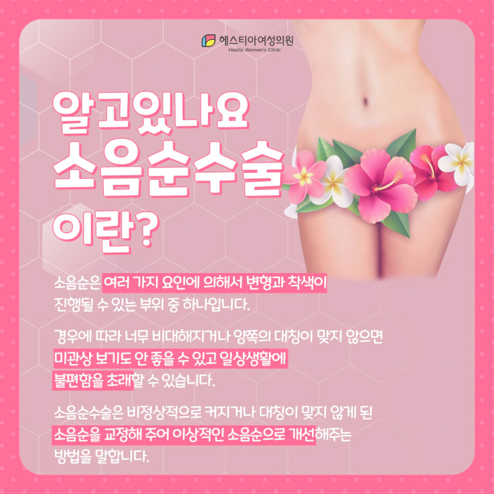 소음순수술이란?