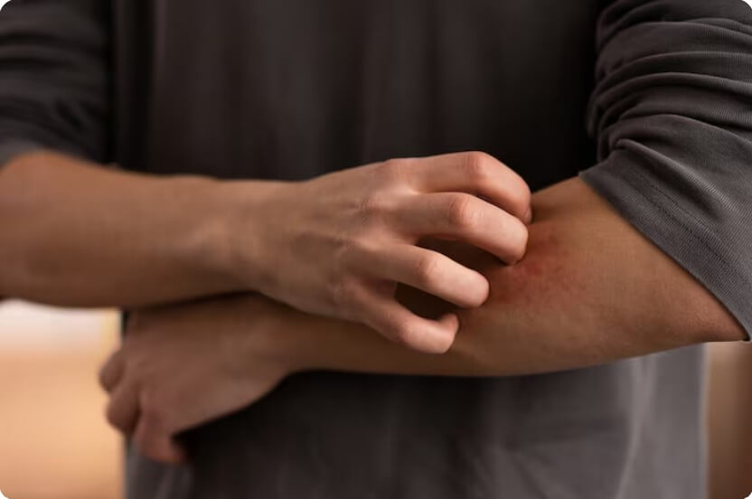 췌장암으로 인한 피부 가려움