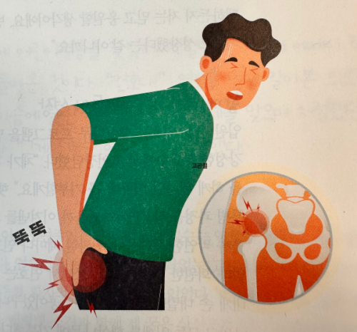 고관절에서 뚝뚝 소리는 왜 나는 걸까?