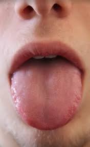 딸꾹질 멈추는 방법