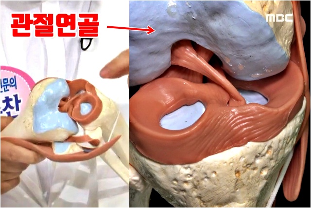 무릎에서 뚝뚝 소리 나는 이유, 앉았다 일어나면 무릎에서 소리가 나요, 무릎에서 소리나고 통증, 건강 팁줌 매일꿀정보