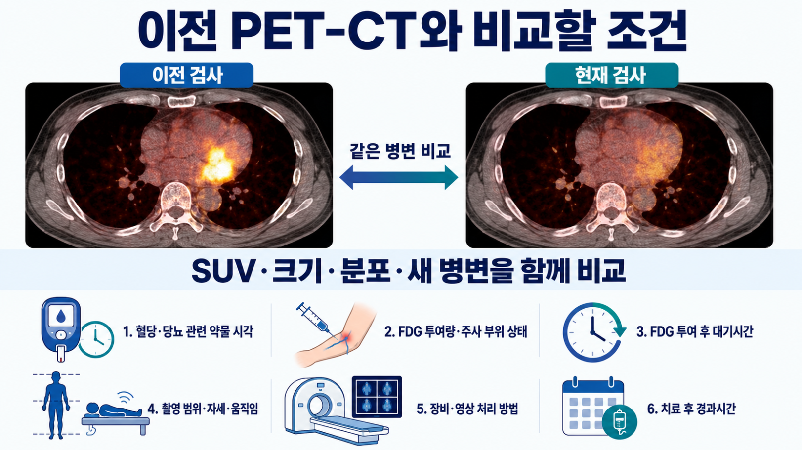 이전 검사와 현재 PET-CT에서 같은 병변의 SUV·크기·분포와 검사 조건을 비교하는 방법을 정리한 이미지
