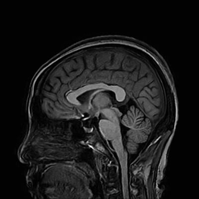 BRAIN-MRI-IMAGE