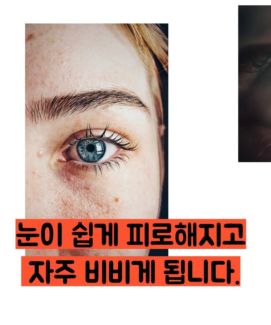 눈에 이물질이 낀것 같은 증상