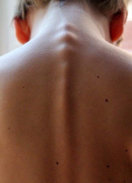 거북목&middot;굽은등 교정 밴드&amp;#44; 무조건 쓰면 안 되는 이유