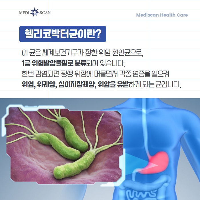 헬리코박터균 증상 치료 해결책