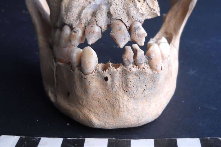 고대 인류의 치아 유전자와 식습관: 음식은 유전자까지 바꾼다