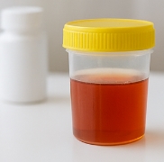 혈뇨가 나오는 이유