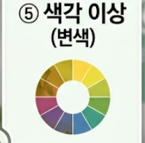 백내장 증상