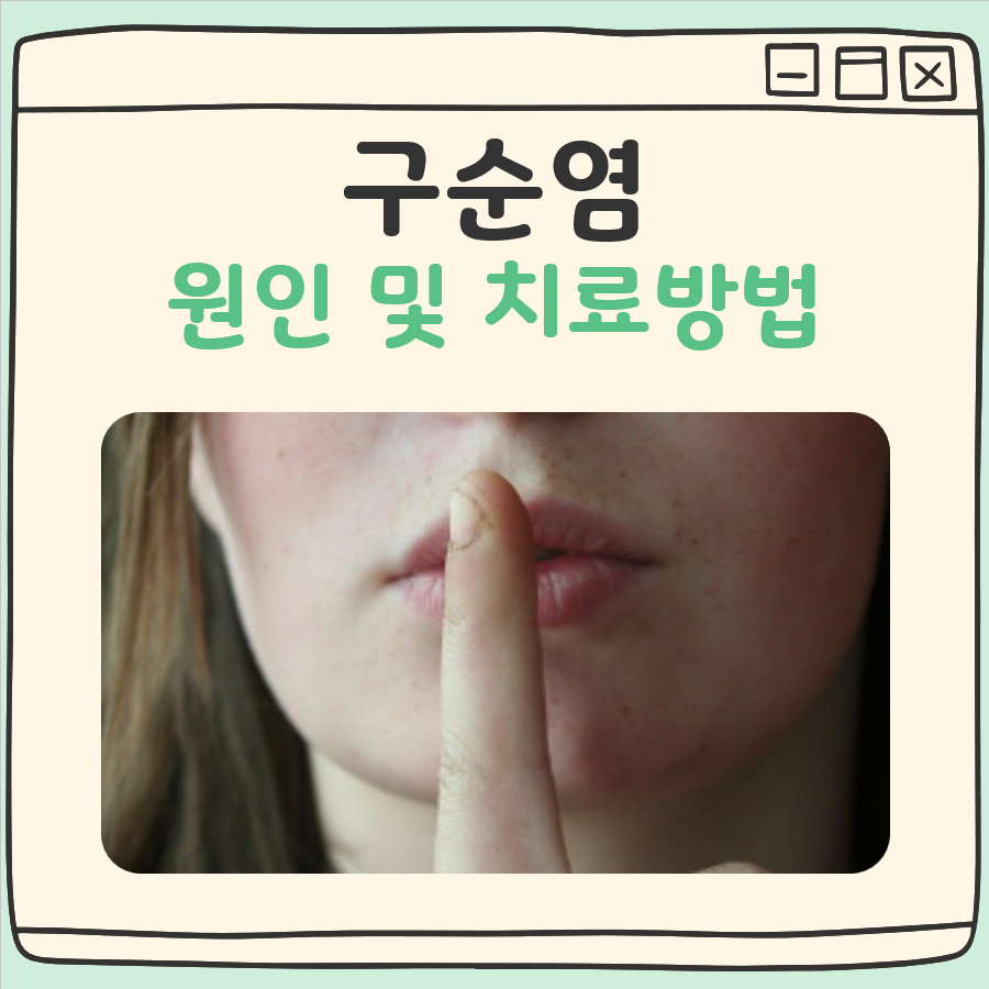 구순염 원인과 치료방법 대표 이미지