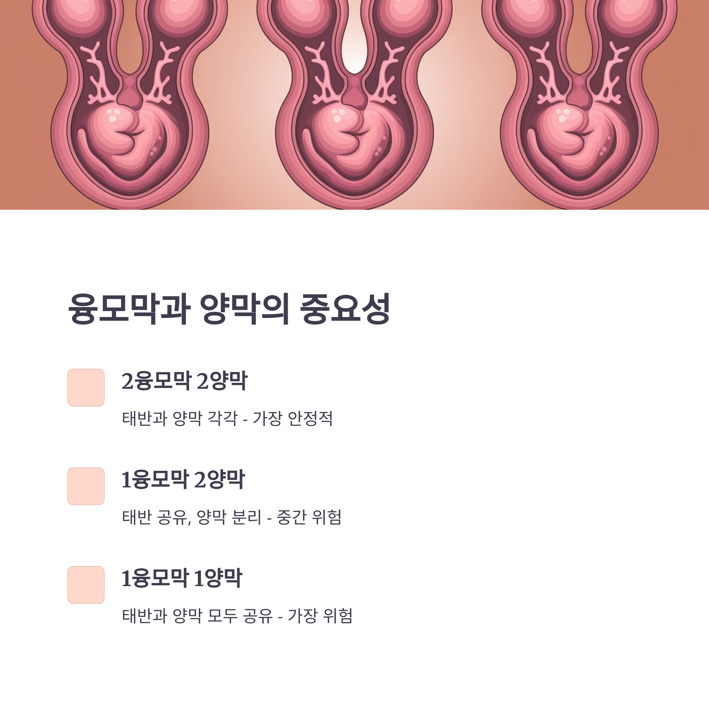 융모막과 양막 수에 따른 쌍둥이 예후 비교