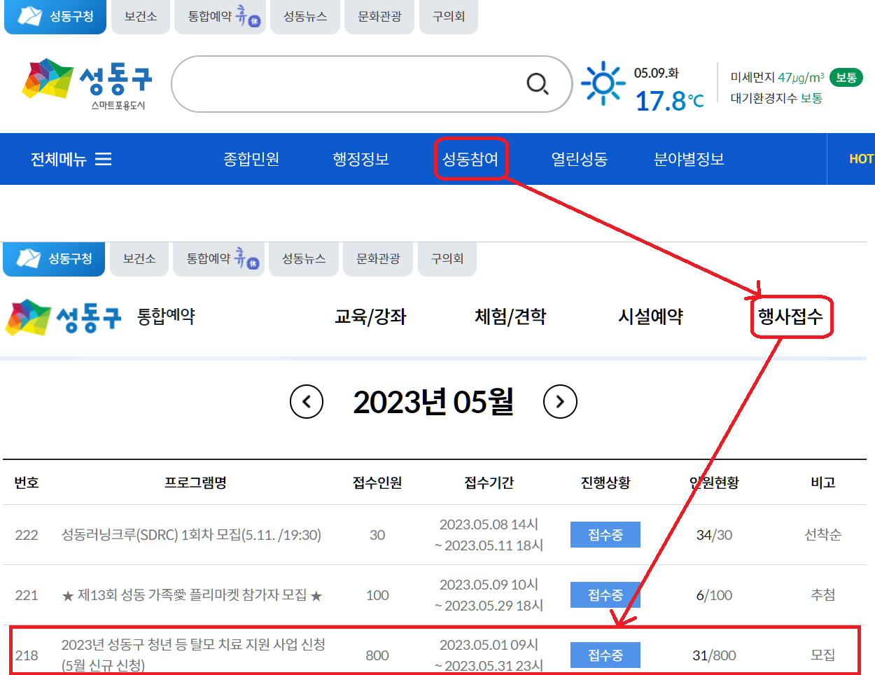 성동구 청년 탈모 치료지원