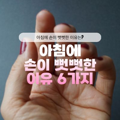 손관절