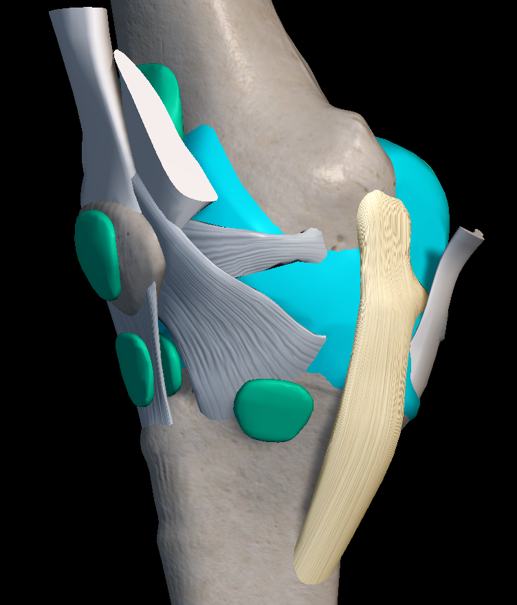 무릎 인대 파열 원인