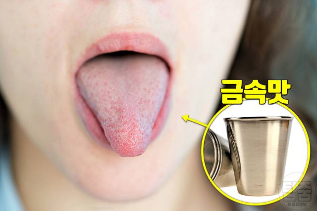 임신초기증상 임신극초기증상 임신테스트기 사용시기