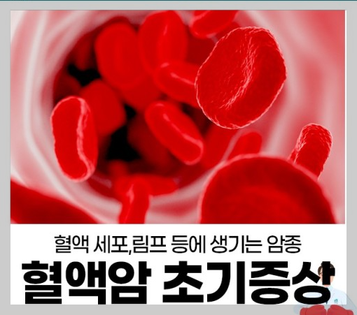 혈액암 초기증상