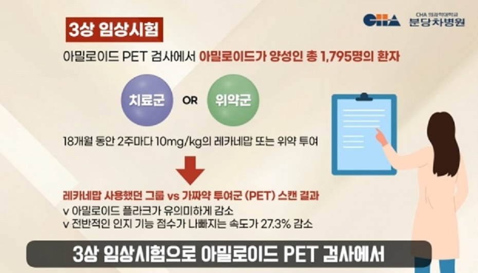 레카네맙-생로병사의비밀-치매-치료제