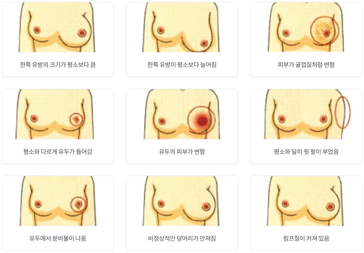 유방암을-증상별로-자가진단-할-수-있게-그림으로-표현한-이미지