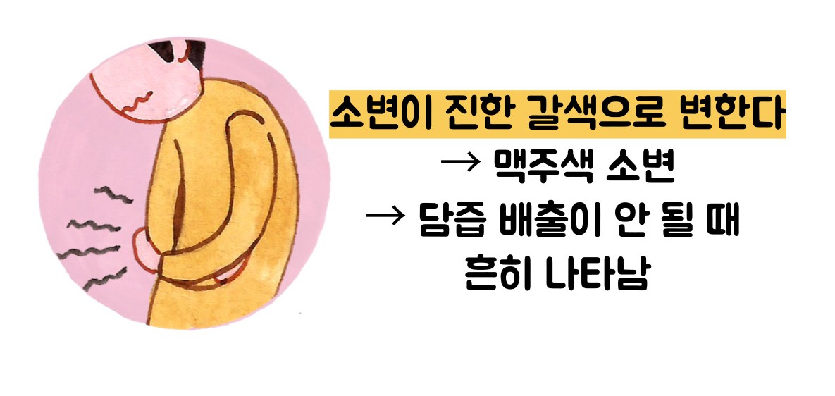 황달 증상