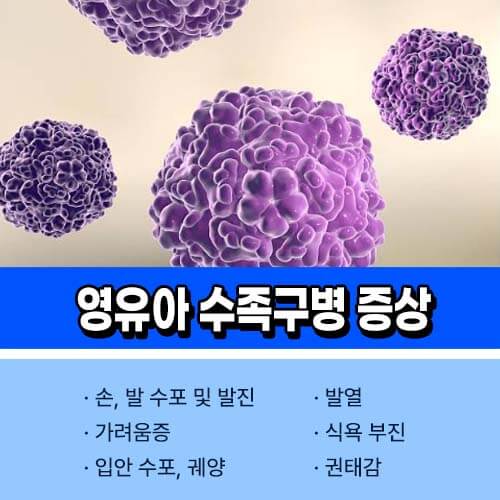 수족구병 증상