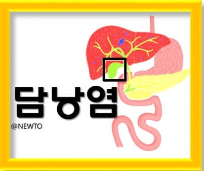 담낭염 관련