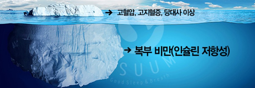 복부비만의 위험성