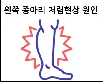 왼쪽 종아리 저림현상 원인
