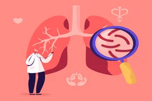 기관지염-치료법