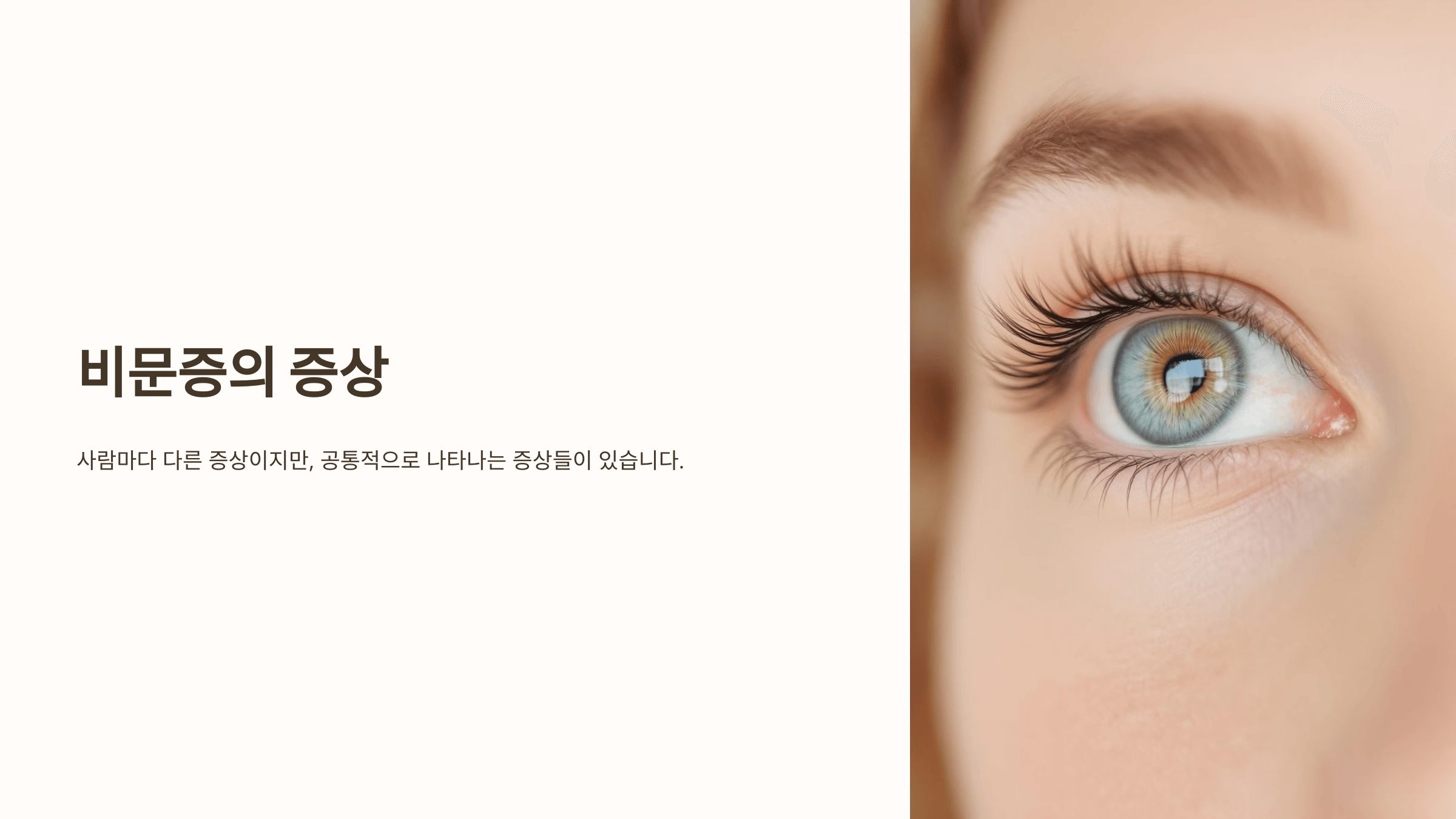 비문증과 관련된 사진입니다.