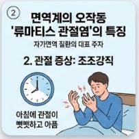 류마티스 관절염 초기증상