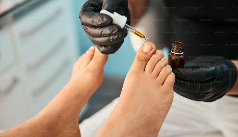 pharmacy-athlete-foot-remedies-price-effectiveness-and-directions