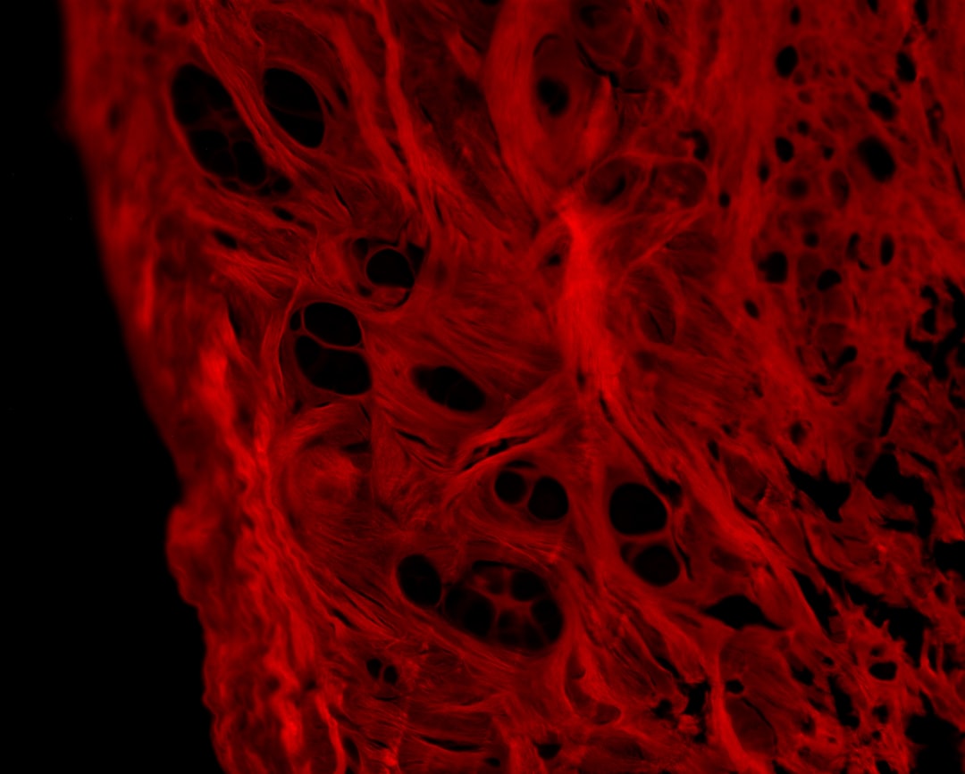 Cartilage
