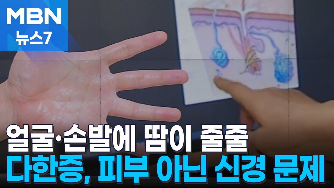 과도한 얼굴 땀, 원인과 치료법을 한 번에 알아보자2